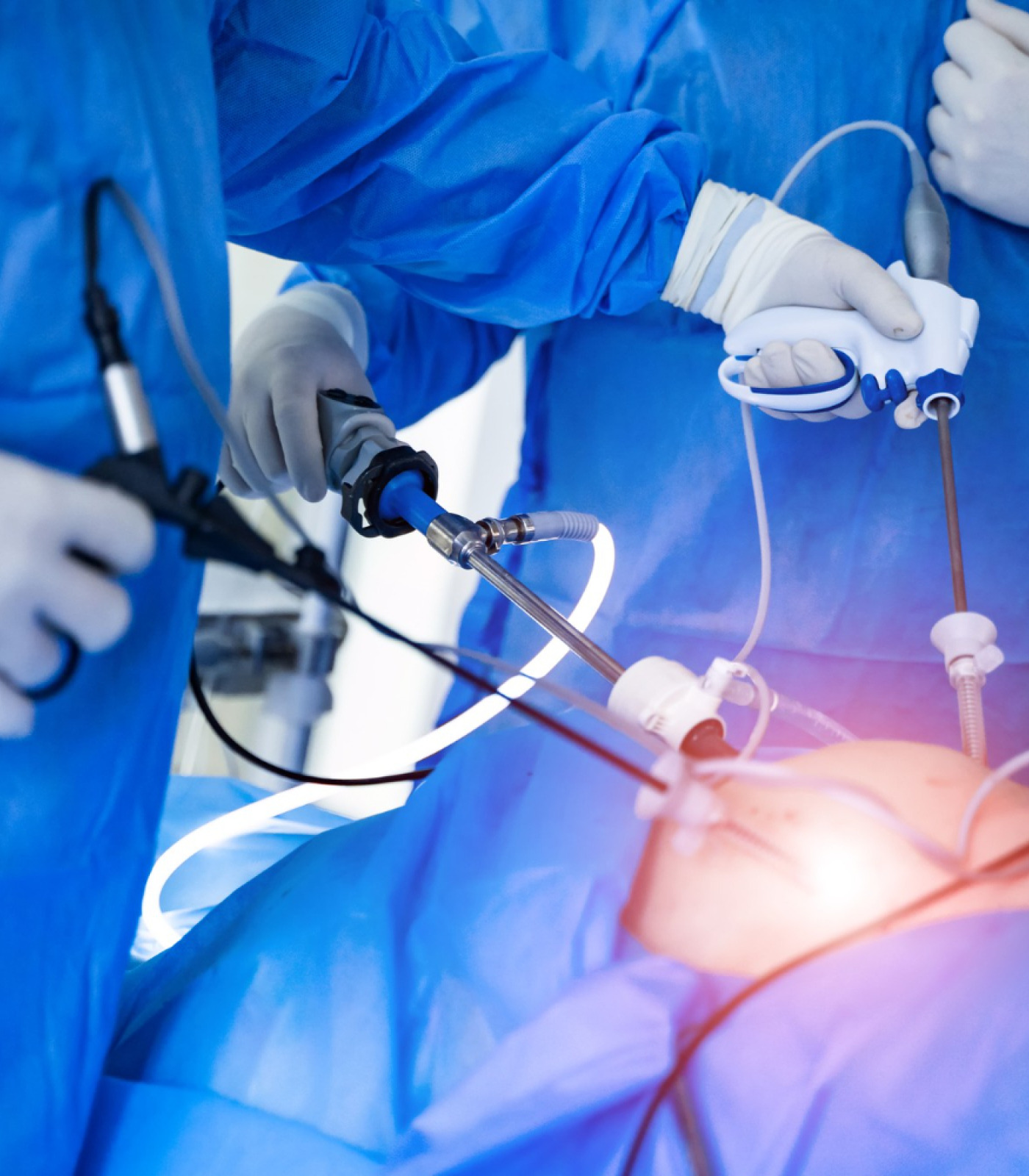 Laparoscopic Surgery in Anna Nagar